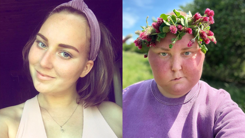 Bojovnice s nádorem mozku Barbora Maťovčíková vydala knihu. Popsala život s nemocí